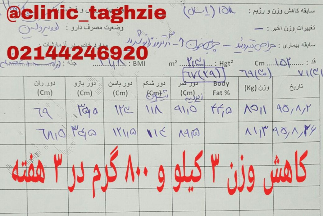 رژیم لاغری