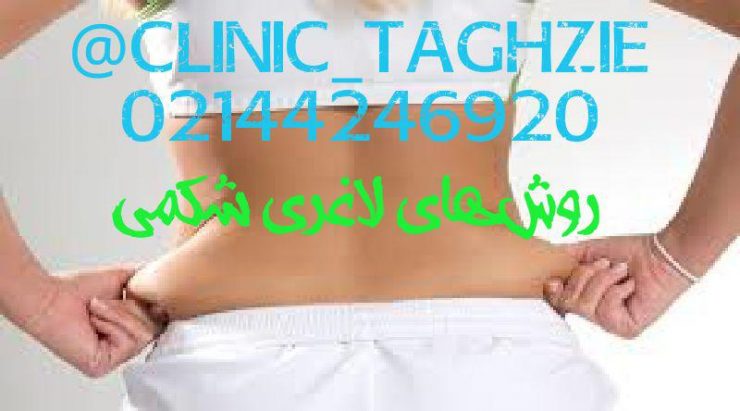 روش‌های کاهش چربی شکمی