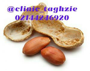 بادام زمینی و افزایش وزن 