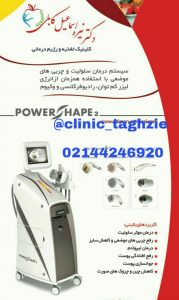 لاغری موضعی