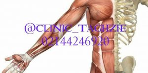 روشهای سالم کاهش وزن