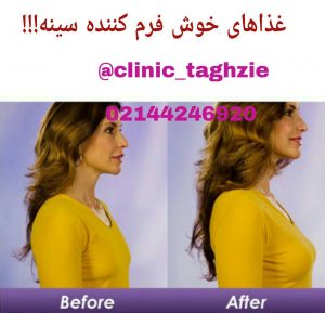 غذای خوش فرم کننده سینه