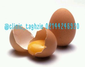 افزایش وزن در کودکان 