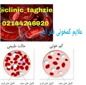 علائم کم خونی