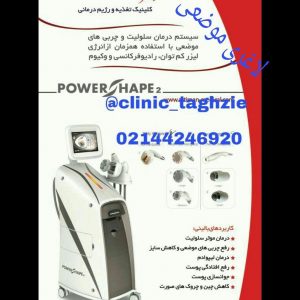 لاغری موضعی
