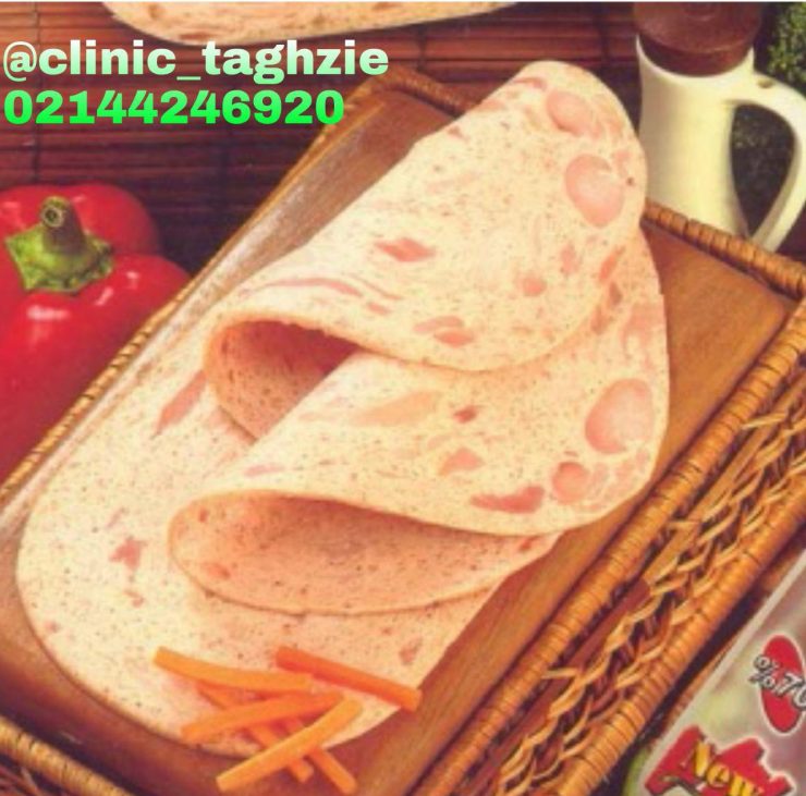 مضرات چیپس