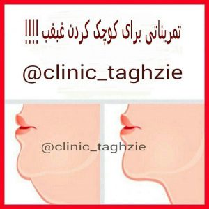 تمریناتی برای کوچک کردن غبغب